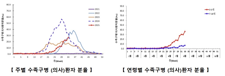 수족구