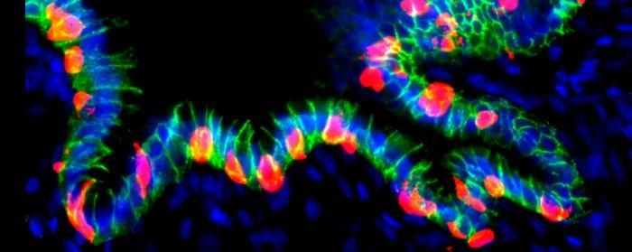 연구팀은 인간배아줄기세포(hESC)로 위 오가노이드(hGO)를 만들고, 이 오가노이드에 췌장 베타세포 전사인자 핵심 유전자 3개(NPM : NEUROG3·PDX1·MAFA)를 삽입했다. 삽입된 유전자 3개는 도시사이클린(doxycycline)이라는 약물로 스위치를 켜고 끌 수 있도록 설계돼 약물을 투여하면 세포 내에서 이 인자들이 발현되며 위 세포가 인슐린 분비 세포로 전환된다. [Hyunkee Kim/Harvard University 제공